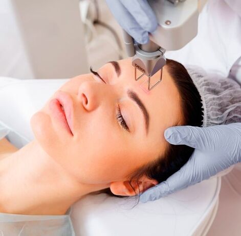 Laser rejuvenation rupina