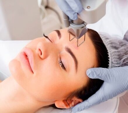 hakekat tina laser fractional prosedur rejuvenation kulit raray
